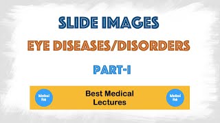 Eye diseases and disorders  Symptoms and treatments  Image based discussion Part1 [upl. by Eilsehc]