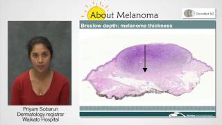 Melanoma Pathology Report [upl. by Assilim135]