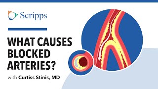 Coronary Artery Disease Causes Symptoms and Treatment with Dr Curtiss Stinis  San Diego Health [upl. by Ariek292]