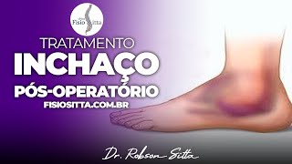 EDEMA INCHAÇO PÓS TRAUMA FRATURA IMOBILIZAÇÃO CONTUSÃO Clínica de Fisioterapia Dr Robson Sitta [upl. by Amati]