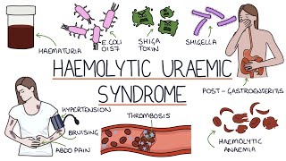 Haemolytic Uraemic Syndrome [upl. by Ynoep]