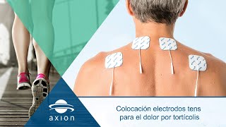 Colocación electrodos TENS para dolor de tortícolis  Electroestimulación TENS para terapia de dolor [upl. by Enniroc884]