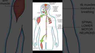 What is amyotrophic lateral sclerosis ALS health healthcare disease viraldisease [upl. by Philipp161]