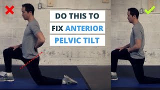 6 Minute Routine to Correct ANTERIOR Pelvic Tilt [upl. by Bowe]