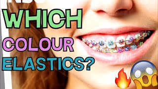 Which Braces Color ELASTICS Should You Get A Simulation To Show Each Colour [upl. by Eikciv]