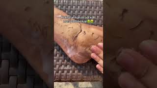 Deep Cleansing Remove Dust and Dead Skin ameenbeautytips [upl. by Enifesoj135]