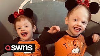 Conjoined twins given 2 survival chance graduate kindergarten  SWNS [upl. by Akimyt585]