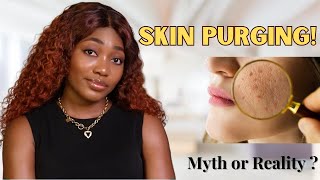 Skin Purging Here’s What You Should Know [upl. by Naitirb714]