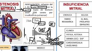 4 RM19 1V D A 2 QX TORAX Y CV ESTENOSIS Y INSUFICIENCIA MITRAL [upl. by Anire]