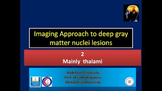 thalamic lesions [upl. by Enelrats395]