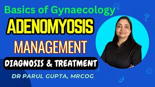 Management of Adenomyosis  Investigations amp Treatment  Part2 [upl. by Oitaroh]