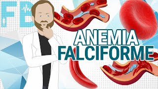 Anemia falciforme [upl. by Boland]