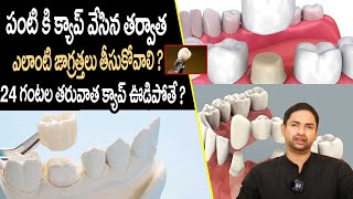 Precautions to Take After Dental Capping  When To Remove Dental Crowns  Way2Health [upl. by Karas]