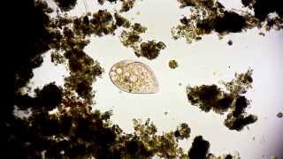 Wimpertierchen  Ciliophora  Ciliata  Ciliate  microorganisms under microscope microcosmos [upl. by Leur499]