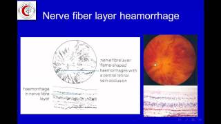 Retina spot diagnosis slides part I [upl. by Ailimat]