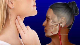 Carotid Artery Neck Pain Causes And Treatment [upl. by Sidney]