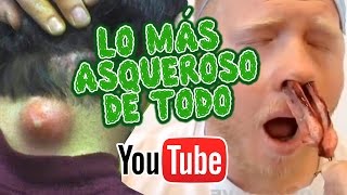 LAS 5 BÚSQUEDAS MÁS ASQUEROSAS DE YOUTUBE  LOS VIDEOS MAS HORRIBLES DE TODO  TOP 5 [upl. by Pepper]