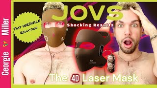 “The Ultimate Skincare Gadget Testing the JOVS 4D Laser Mask amp Black Friday Early Bird Access” [upl. by Gewirtz576]