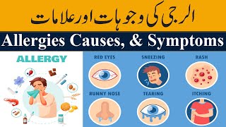 What is Allergy  Causes Signs and Symptoms Must Watch [upl. by Airemahs]