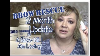 ✅BROW RESCUE2 Month UpdateGrow Eyebrows Fast wLatisseCareprostLatanoprostOver 40 Beauty [upl. by Kelby98]