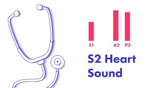 Split S2 Heart Sound  Learn How to Auscultate [upl. by Prem74]