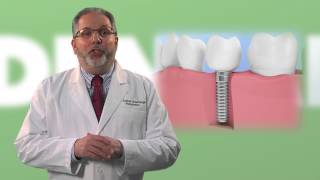 What You Need to Know About Tooth Grinding [upl. by Ainesell]