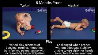 6 Month Old Baby Typical amp Atypical Development Side by Side [upl. by Neelhtak]