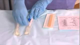 Sample Collection Throat swabs [upl. by Prosser]