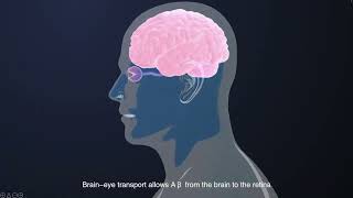 Transport of βamyloid from brain to eye causes retinal degeneration in Alzheimer’s disease [upl. by Ntsud567]