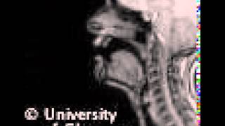 MRI voiced dental fricative [upl. by Assenov]