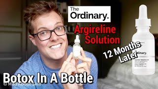 THE ORDINARY ARGIRELINE SOLUTION  12 Months later  The Ordinary Argireline 10 Review [upl. by Ettenahc259]