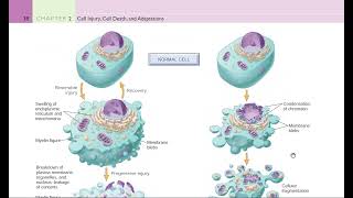 PATHO2 The Progression of Cell Injury amp Death [upl. by Shedd627]