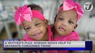 A Mothers Plea Woman Seeks help to Separate Conjoined Twins  TVJ News [upl. by Grieve677]