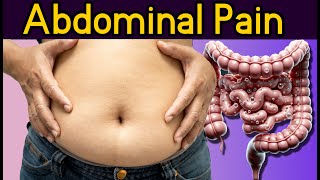 Abdominal Pain Causes Diffuse Nonlocalized abdominal pain [upl. by Orferd]