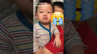 Croup Difficulty breathing Barking cough [upl. by Ainat]