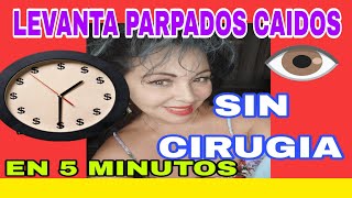 COMO LEVANTAR LOS PARPADOS CAIDOS EN 5 MINUTOS SIN CIRUGIA [upl. by Gerti]