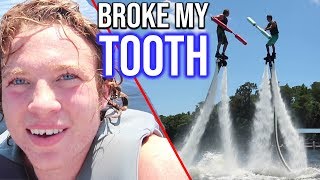 Flyboarding Ruined My Smile [upl. by Patman9]