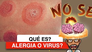 Alergia o virus que significa en los niños DrB te lo explica Dermatológico Pediatria [upl. by Aikat]