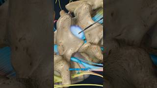 Lumbar Epidural Steroid Injection 3D Animation [upl. by Egwan836]