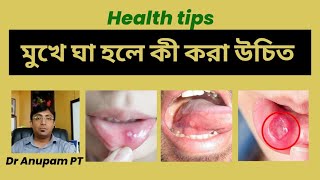 মুখে ঘা হলে কি করণীয়canker sore treatmenthealthtips bangla dranupampt [upl. by Aihceyt696]