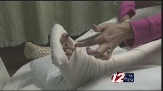 Woman Bitten by Fisher Cat in Lincoln [upl. by Iaverne78]