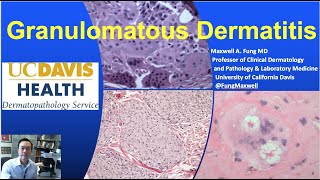 DERMATOPATHOLOGY Granulomatous Dermatitis [upl. by Melena]