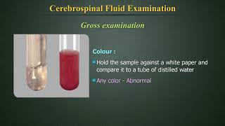 Cerebrospinal Fluid Examination CSF [upl. by Jean-Claude]