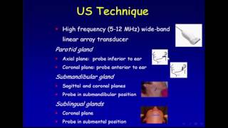 Ultrasound of the Salivary Glands [upl. by Cirde622]