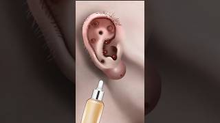 Ear infection treatment asmr skincareanimation makeupanimation asmrvideo makeuptutorial [upl. by Icul]