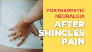 Post herpetic NeuralgiaTerrible Pain After Shingles [upl. by Warp744]