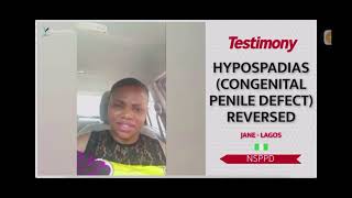 Hypospadias Congenital Penile Defect Reversed nsppdtestimony congenital throneroomverdict [upl. by Fritzsche495]