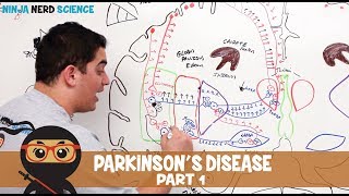 Parkinsons Disease  Clinical Presentation  Part 1 [upl. by Karry]