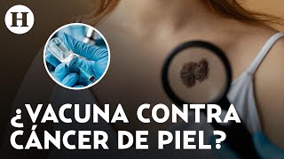 ¡Un gran avance médico Prueban la primera vacuna contra el cáncer de piel en Reino Unido [upl. by Bravar]