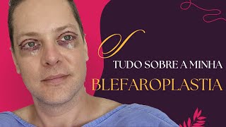 Tudo sobre a minha BLEFAROPLASTIA Cirurgia de Pálpebras [upl. by Meagher833]